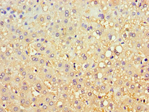 Immunohistochemistry of paraffin-embedded human liver tissue using CBR3 Antibody at dilution of 1:100