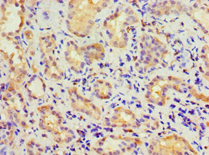 Immunohistochemistry of paraffin-embedded human kidney tissue using CBR3 Antibody at dilution of 1:100
