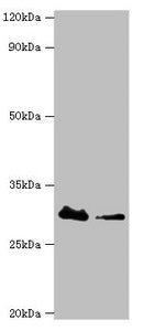 Western blot | All lanes: Carbonyl reductase [NADPH] 3 antibody at 10μg/ml | Lane 1: Hela whole cell lysate | Lane 2: K562 whole cell lysate | Secondary | Goat polyclonal to rabbit IgG at 1/10000 dilution | Predicted band size: 31 kDa | Observed band size: 31 kDa
