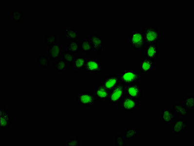 Immunofluorescence staining of Hela cells with CBX4 Antibody at 1:100, counter-stained with DAPI. The cells were fixed in 4% formaldehyde, permeabilized using 0.2% Triton X-100 and blocked in 10% normal Goat Serum. The cells were then incubated with the antibody overnight at 4°C. The secondary antibody was Alexa Fluor 488-congugated AffiniPure Goat Anti-Rabbit IgG(H+L).