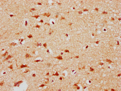 IHC image of CBX4 Antibody diluted at 1:300 and staining in paraffin-embedded human brain tissue performed on a Leica BondTM system. After dewaxing and hydration, antigen retrieval was mediated by high pressure in a citrate buffer (pH 6.0). Section was blocked with 10% normal goat serum 30min at RT. Then primary antibody (1% BSA) was incubated at 4°C overnight. The primary is detected by a biotinylated secondary antibody and visualized using an HRP conjugated SP system.