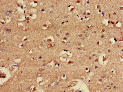 Immunohistochemistry of paraffin-embedded human brain tissue using CBX5 Antibody at dilution of 1:100