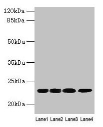 Western blot  | All lanes: CBX5 antibody at 9µg/ml  | Lane 1: K562 whole cell lysate  | Lane 2: MCF-7 whole cell lysate  | Lane 3: 293T whole cell lysate  | Lane 4: Hela whole cell lysate  | Secondary  | Goat polyclonal to rabbit IgG at 1/10000 dilution  | Predicted band size: 23 kDa  | Observed band size: 23 kDa