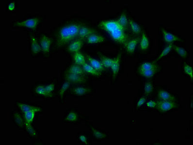 Immunofluorescence staining of HepG2 cells with the antibody at 1:100, counter-stained with DAPI. The cells were fixed in 4% formaldehyde, permeabilized using 0.2% Triton X-100 and blocked in 10% normal Goat Serum. The cells were then incubated with the antibody overnight at 4°C. The secondary antibody was Alexa Fluor 488-congugated AffiniPure Goat Anti-Rabbit IgG(H+L).Rabbit anti-Human YARS Polyclonal Antibody