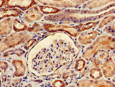 Immunohistochemistry of paraffin-embedded human kidney tissue using YARS Antibody at dilution of 1:100Rabbit anti-Human YARS Polyclonal Antibody