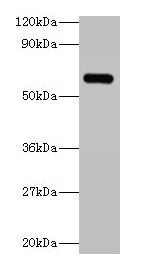 Western blot  | All lanes: YARS antibody at 2µg/ml + 293T whole cell lysate  | Secondary  | Goat polyclonal to rabbit IgG at 1/15000 dilution  | Predicted band size: 60 kDa  | Observed band size: 60 kDaRabbit anti-Human YARS Polyclonal Antibody