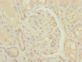 Immunohistochemistry of paraffin-embedded human kidney tissue using CCHCR1 Antibody at dilution of 1:100