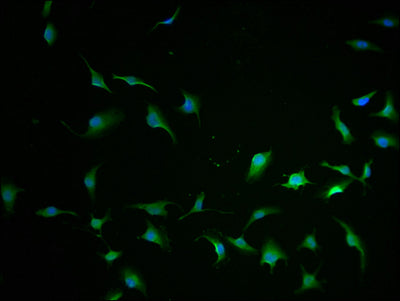 Immunofluorescence staining of U251 cells with CCHCR1 Antibody-IF at 1:100, counter-stained with DAPI. The cells were fixed in 4% formaldehyde and blocked in 10% normal Goat Serum. The cells were then incubated with the antibody overnight at 4°C. The secondary antibody was Alexa Fluor 488-congugated AffiniPure Goat Anti-Rabbit IgG(H+L).