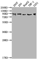 Western Blot | Positive WB detected in: 293T whole cell lysate, 293 whole cell lysate, HepG2 whole cell lysate, THP-1 whole cell lysate, U251 whole cell lysate | All lanes: CCHCR1 antibody at 1:2000 | Secondary | Goat polyclonal to rabbit IgG at 1/50000 dilution | Predicted band size: 89, 100, 96 kDa | Observed band size: 89 kDa