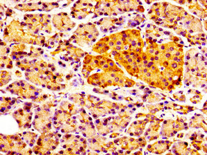 IHC image of CCKAR Antibody diluted at 1:100 and staining in paraffin-embedded human pancreatic tissue performed on a Leica BondTM system. After dewaxing and hydration, antigen retrieval was mediated by high pressure in a citrate buffer (pH 6.0). Section was blocked with 10% normal goat serum 30min at RT. Then primary antibody (1% BSA) was incubated at 4°C overnight. The primary is detected by a biotinylated secondary antibody and visualized using an HRP conjugated SP system.