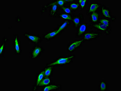 Immunofluorescent analysis of Hela cells using CCNC Antibody at dilution of 1:100 and Alexa Fluor 488-congugated AffiniPure Goat Anti-Rabbit IgG(H+L)Rabbit anti-Human CCNC Polyclonal Antibody