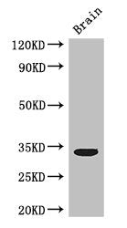Western Blot | Positive WB detected in: Mouse brain tissue | All lanes: CCNC antibody at 3μg/ml | Secondary | Goat polyclonal to rabbit IgG at 1/50000 dilution | Predicted band size: 34, 23 kDa | Observed band size: 34 kDaRabbit anti-Human CCNC Polyclonal Antibody