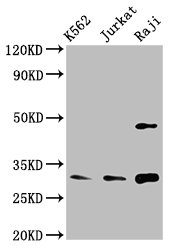 Western Blot  | Positive WB detected in: K562 whole cell lysate, Jurkat whole cell lysate, Raji whole cell lysate  | All lanes: CCND3 antibody at 3.4µg/ml  | Secondary  | Goat polyclonal to rabbit IgG at 1/50000 dilution  | Predicted band size: 33 kDa  | Observed band size: 33 kDaRabbit anti-Human CCND3 Polyclonal Antibody