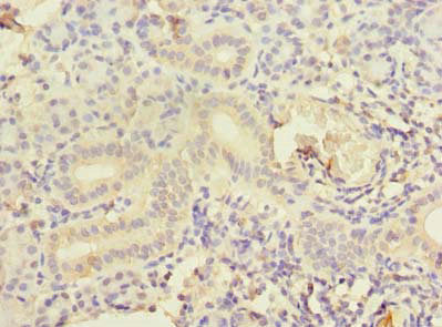 Immunohistochemistry of paraffin-embedded human pancreatic tissue using CCNJL Antibody at dilution of 1:100Rabbit anti-Human CCNJL Polyclonal Antibody