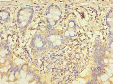 Immunohistochemistry of paraffin-embedded human small intestine tissue using CCNJL Antibody at dilution of 1:100Rabbit anti-Human CCNJL Polyclonal Antibody