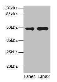 Western blot  | All lanes: CCNJL antibody at 3µg/ml  | Lane 1: U251 whole cell lysate  | Lane 2: Mouse liver tissue  | Secondary  | Goat polyclonal to rabbit IgG at 1/10000 dilution  | Predicted band size: 49, 19 kDa  | Observed band size: 49 kDaRabbit anti-Human CCNJL Polyclonal Antibody