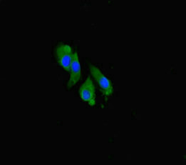 Immunofluorescent analysis of Hela cells using CCNO Antibody at dilution of 1:100 and Alexa Fluor 488-congugated AffiniPure Goat Anti-Rabbit IgG(H+L)Rabbit anti-Human CCNO Polyclonal Antibody