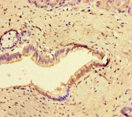 Immunohistochemistry of paraffin-embedded human pancreatic tissue using CCNO Antibody at dilution of 1:100Rabbit anti-Human CCNO Polyclonal Antibody