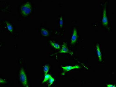 Immunofluorescent analysis of U251 cells using CCR1 Antibody at dilution of 1:100 and Alexa Fluor 488-congugated AffiniPure Goat Anti-Rabbit IgG(H+L)Rabbit anti-Human CCR1 Polyclonal Antibody