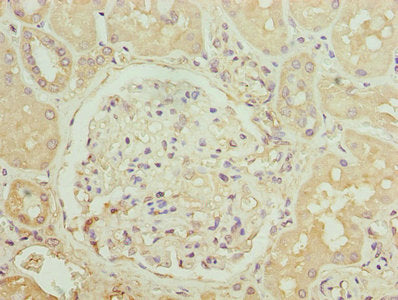 Immunohistochemistry of paraffin-embedded human kidney tissue using CCR1 Antibody at dilution of 1:100Rabbit anti-Human CCR1 Polyclonal Antibody