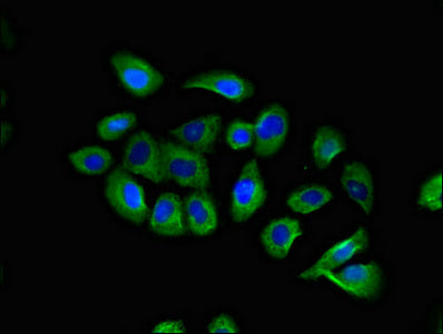 Immunofluorescent analysis of A549 cells using CCR10 Antibody at dilution of 1:100 and Alexa Fluor 488-congugated AffiniPure Goat Anti-Rabbit IgG(H+L)Rabbit anti-Human CCR10 Polyclonal Antibody