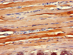 Immunohistochemistry of paraffin-embedded human skeletal muscle tissue using the antibody at dilution of 1:100Rabbit anti-Human CCR10 Polyclonal Antibody