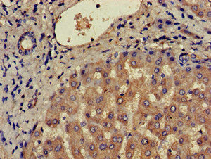Immunohistochemistry of paraffin-embedded human liver tissue using CCR3 Antibody at dilution of 1:100Rabbit anti-Human CCR3 Polyclonal Antibody