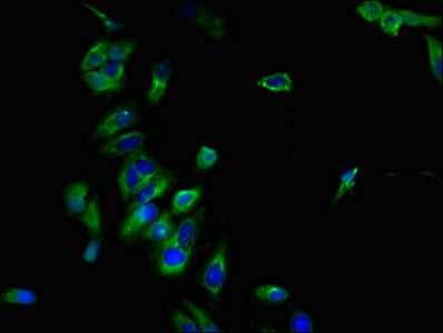 Immunofluorescent analysis of Hela cells using CCR7 Antibody at dilution of 1:100 and Alexa Fluor 488-congugated AffiniPure Goat Anti-Rabbit IgG(H+L)Rabbit anti-Human CCR7 Polyclonal Antibody