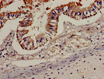 Immunohistochemistry analysis of human lung tissue using the antibody at dilution of 1:100Rabbit anti-Human CCR7 Polyclonal Antibody