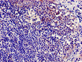 Immunocytochemistry analysis of human tonsil tissue using CCR7 Antibody at dilution of 1:100Rabbit anti-Human CCR7 Polyclonal Antibody