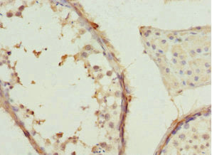 Immunohistochemistry of paraffin-embedded human testis tissue using CCT2 Antibody at dilution of 1:100Rabbit anti-Human CCT2 Polyclonal Antibody