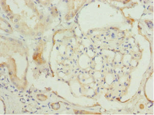 Immunohistochemistry of paraffin-embedded human kidney tissue using CCT2 Antibody at dilution of 1:100Rabbit anti-Human CCT2 Polyclonal Antibody