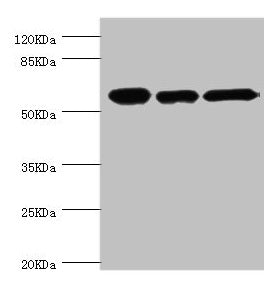 Western blot | All lanes: CCT2 antibody at 5.63μg/ml | Lane 1: Jurkat whole cell lysate | Lane 2: NIH/3T3 whole cell lysate | Lane 3: MCF-7 whole cell lysate | Secondary | Goat polyclonal to rabbit IgG at 1/10000 dilution | Predicted band size: 58, 53 kDa | Observed band size: 58 kDa