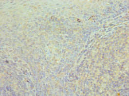 Immunohistochemistry of paraffin-embedded human tonsil tissue using CCT3 Antibody at dilution of 1:100Rabbit anti-Human CCT3 Polyclonal Antibody