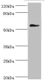 Western blot | All lanes: T-complex protein 1 subunit gamma antibody at 12μg/ml + Mouse brain tissue | Secondary | Goat polyclonal to rabbit IgG at 1/10000 dilution | Predicted band size: 61, 57 kDa | Observed band size: 61 kDa