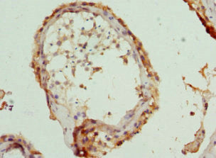 Immunohistochemistry of paraffin-embedded human testis tissue using CCT5 Antibody at dilution of 1:100Rabbit anti-Human CCT5 Polyclonal Antibody