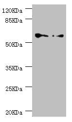 Western blot  | All lanes: CCT5 antibody at 1.78µg/ml  | Lane 1: Hela whole cell lysate  | Lane 2: Colo320 whole cell lysate  | Secondary  | Goat polyclonal to rabbit IgG at 1/10000 dilution  | Predicted band size: 60, 50 kDa  | Observed band size: 60 kDaRabbit anti-Human CCT5 Polyclonal Antibody