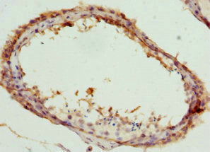Immunohistochemistry of paraffin-embedded human testis tissue using CCT5 Antibody at dilution of 1:100Rabbit anti-Human CCT5 Polyclonal Antibody