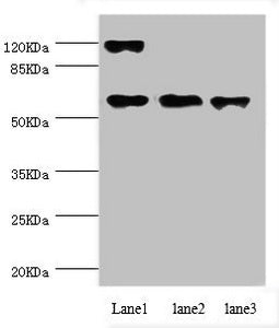 Western blot | All lanes: CCT5 antibody at 1.84μg/ml | Lane 1: Hela whole cell lysate | Lane 2: Colo320 whole cell lysate | Lane 3: Mouse ovarian tissue | Secondary | Goat polyclonal to rabbit IgG at 1/10000 dilution | Predicted band size: 60, 50 kDa | Observed band size: 60 kDa