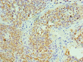 Immunohistochemistry of paraffin-embedded human tonsil tissue using CCT6A Antibody at dilution of 1:100Rabbit anti-Human CCT6A Polyclonal Antibody
