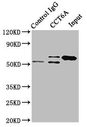 Immunoprecipitating CCT6A in Hela whole cell lysate | Lane 1: Rabbit control IgG instead of CCT6A Antibody in Hela whole cell lysate. | For western blotting, a HRP-conjugated Protein G antibody was used as the secondary antibody (1/2000) | Lane 2: CCT6A Antibody (8μg) + Hela whole cell lysate (500μg) | Lane 3: Hela whole cell lysate (10μg)Rabbit anti-Human CCT6A Polyclonal Antibody
