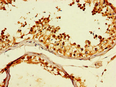 Immunohistochemistry of paraffin-embedded human testis tissue using CCT8 Antibody at dilution of 1:100Rabbit anti-Human CCT8 Polyclonal Antibody