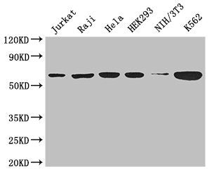 Western Blot  | Positive WB detected in: Jurkat whole cell lysate, Raji whole cell lysate, Hela whole cell lysate, HEK293 whole cell lysate, NIH/3T3 whole cell lysate, K562 whole cell lysate  | All lanes: CCT8 antibody at 3µg/ml  | Secondary  | Goat polyclonal to rabbit IgG at 1/50000 dilution  | Predicted band size: 60, 58, 52 kDa  | Observed band size: 60 kDaRabbit anti-Human CCT8 Polyclonal Antibody