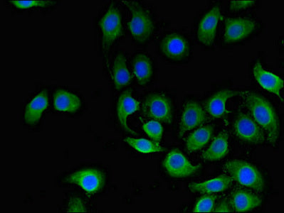 Immunofluorescent analysis of A549 cells using CD151 Antibody at dilution of 1:100 and Alexa Fluor 488-congugated AffiniPure Goat Anti-Rabbit IgG(H+L)Rabbit anti-Human CD151 Polyclonal Antibody