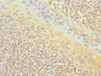 Immunohistochemistry of paraffin-embedded human tonsil tissue using CD1C Antibody at dilution of 1:100Rabbit anti-Human CD1C Polyclonal Antibody