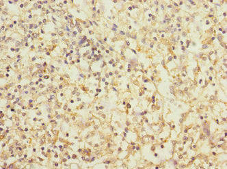 Immunohistochemistry of paraffin-embedded human spleen tissue using CD1C Antibody at dilution of 1:100Rabbit anti-Human CD1C Polyclonal Antibody