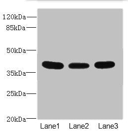 Western blot | All lanes: CD1C antibody at 3.89μg/ml | Lane 1: HepG2 whole cell lysate | Lane 2: A549 whole cell lysate | Lane 3: MCF-7 whole cell lysate | Secondary | Goat polyclonal to rabbit IgG at 1/10000 dilution | Predicted band size: 38 kDa | Observed band size: 38 kDaRabbit anti-Human CD1C Polyclonal Antibody