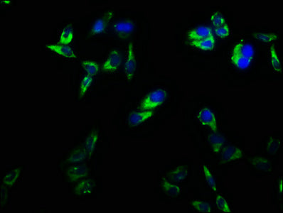 Immunofluorescence staining of Hela cells with the antibody at 1:166, counter-stained with DAPI. The cells were fixed in 4% formaldehyde, permeabilized using 0.2% Triton X-100 and blocked in 10% normal Goat Serum. The cells were then incubated with the antibody overnight at 4°C. The secondary antibody was Alexa Fluor 488-congugated AffiniPure Goat Anti-Rabbit IgG(H+L).Rabbit anti-Human CD2 Polyclonal Antibody