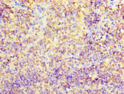 Immunohistochemistry of paraffin-embedded human tonsil tissue using CD2 Antibody at dilution of 1:100Rabbit anti-Human CD2 Polyclonal Antibody
