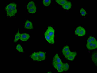 Immunofluorescence staining of HepG2 cells with CD2AP Antibody at 1:66, counter-stained with DAPI. The cells were fixed in 4% formaldehyde, permeabilized using 0.2% Triton X-100 and blocked in 10% normal Goat Serum. The cells were then incubated with the antibody overnight at 4°C. The secondary antibody was Alexa Fluor 488-congugated AffiniPure Goat Anti-Rabbit IgG(H+L).Rabbit anti-Human CD2AP Polyclonal Antibody